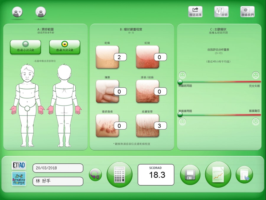 你的異位性皮膚炎多嚴重？ 自己動手評估一下吧！ Screenshot_20180320-172648