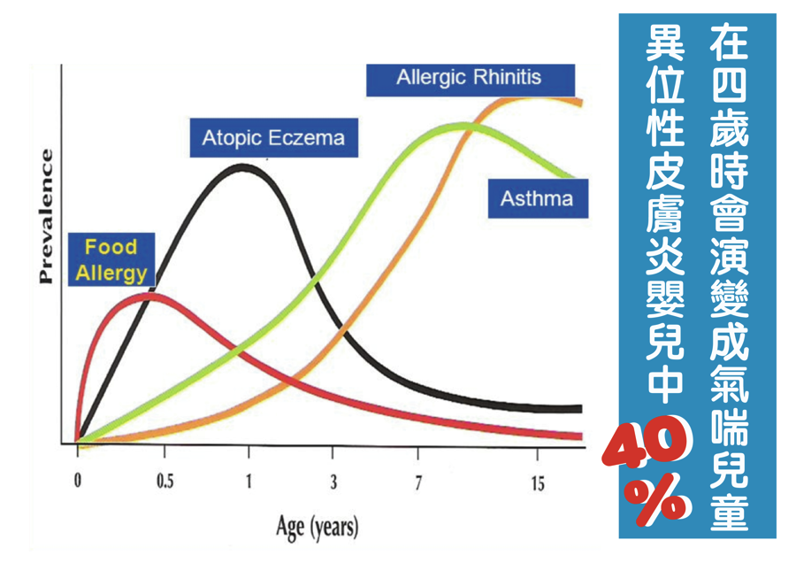 【過敏大哉問】如何判斷自己是哪種過敏症狀？ 03